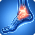 Total Ankle Replacement Picture