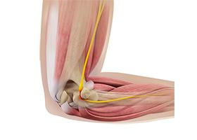 Ulnar Nerve Release