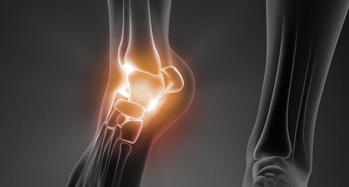 Foot and Ankle