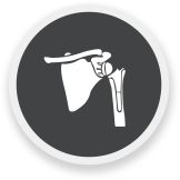 Revision Arthroplasty