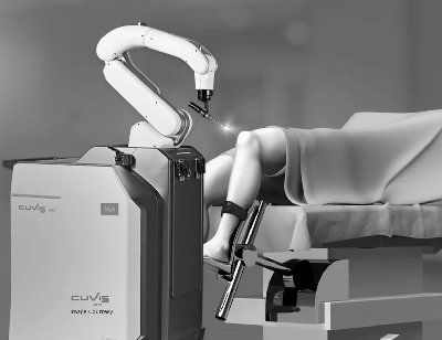 Minimally Invasive Robotic Knee Replacement 