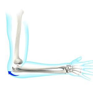 Elbow Instability