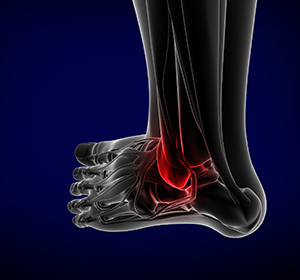 foot-and-ankle-trauma