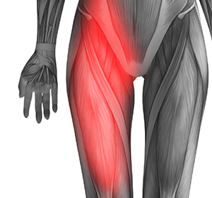 Hip Flexor Pain
