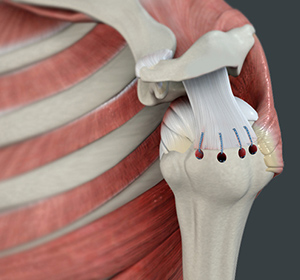 Shoulder