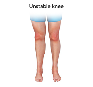 Knee