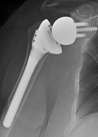 shoulder performance