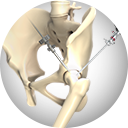 Hip Arthroscopy Services