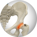  Hip Labral Repair Services