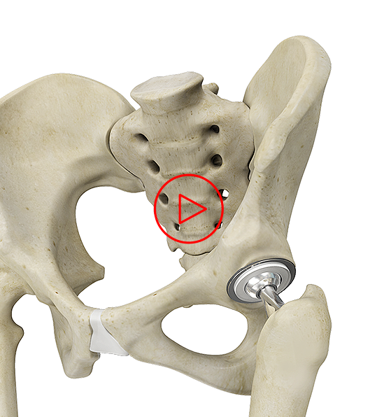 Patient Education Videos