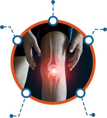 Arthrosamid® Injection 