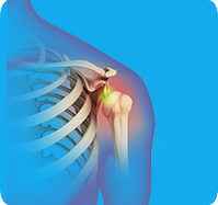 Shoulder Dislocation sp