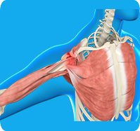 Shoulder Impingement sp