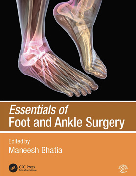 Essentials of Foot and Ankle Surgery Book