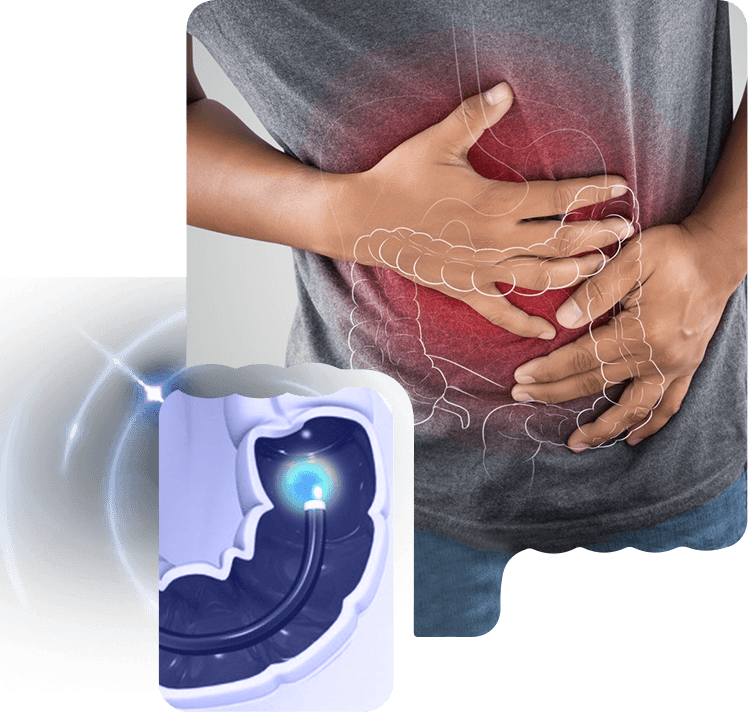 Colonoscopy