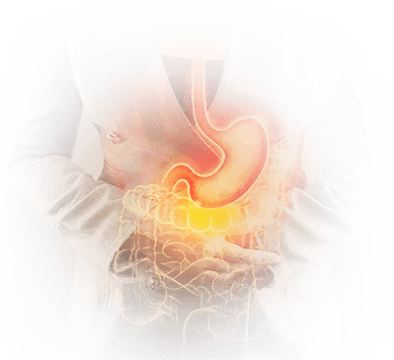 Gastroesophageal Reflux Disease