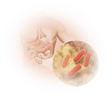 Small Intestinal Bacterial Overgrowth