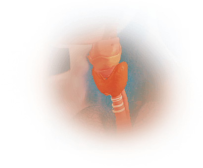 Swallowing Disorders