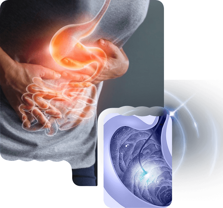 Upper GI Endoscopy