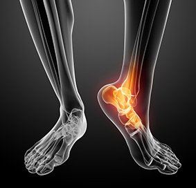 foot