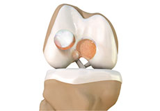 Articular Cartilage