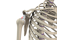 Shoulder Instability logo