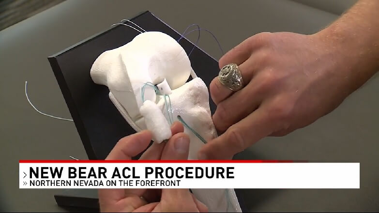 New ACL surgery offered in Reno could shorten recovery time