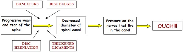 img- spinal stenosis