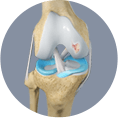 Cartilage-Restoration