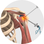Arthroscopic Surgery Home