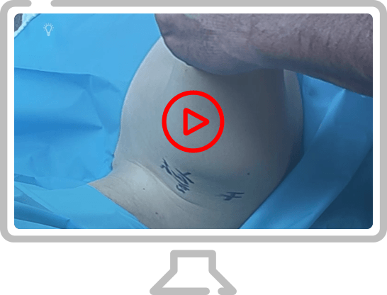 Shoulder Multi-Direction Instability Home