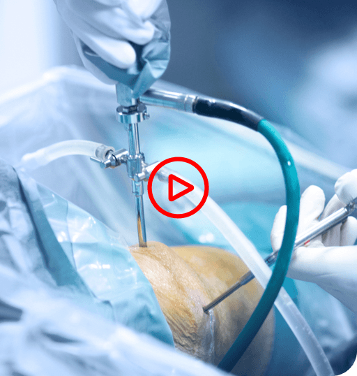 Patient Education Video