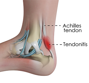 Foot & Ankle
