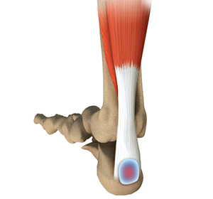 Foot & Ankle