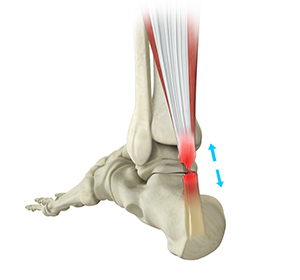 Foot & Ankle