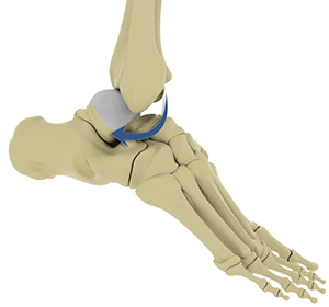 Foot & Ankle
