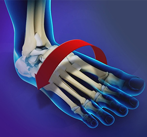 Foot & Ankle