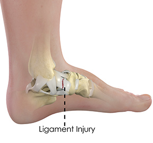 Foot & Ankle