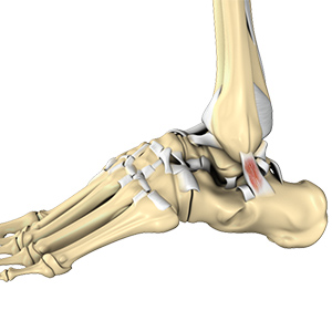 Foot & Ankle