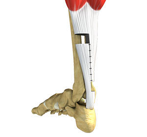 Foot & Ankle