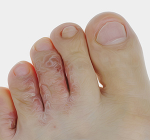 Foot & Ankle