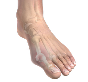 Foot & Ankle