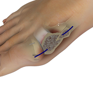 Foot & Ankle