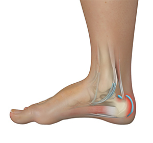 Foot & Ankle