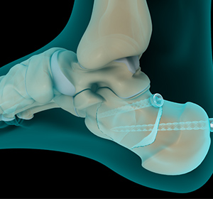 Foot & Ankle