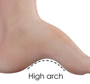 Foot & Ankle