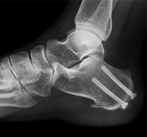 Foot & Ankle
