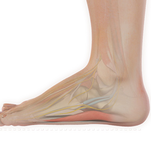 Foot & Ankle