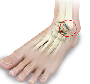 Foot & Ankle