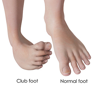Foot & Ankle